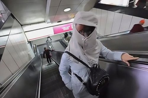 Qızın doğum ləkəsini itirmək üçün qəribə üsul: Dərisi soyuldu, dəyişdirildi... - FOTOLAR