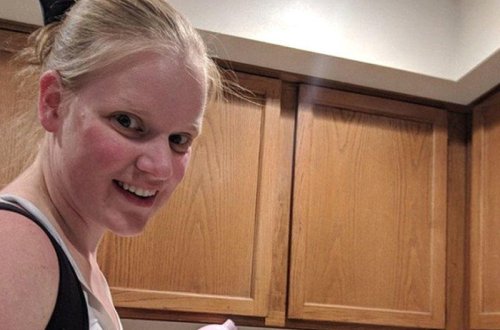 Bu qadın gündə 6 litr süd verir - hiperlaktasiya sindromu - FOTO