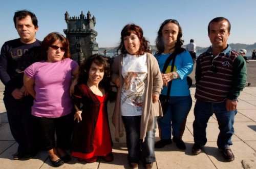 Azərbaycanda cırtdanboyluların sayı artır - Müalicəsi var - VİDEO