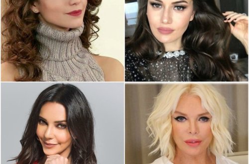 Məşhurlar estetik əməliyyatdan öncə bu gündə olub - ŞOK FOTOLAR