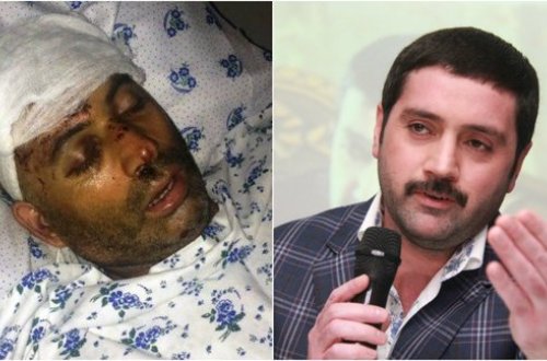 İzzətin cangüdəni onu toyda döyüb bu hala saldı - MƏHKƏMƏ