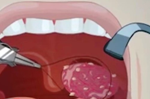 İnsan səsini dəyişdirmək mümkündürmü? – AÇIQLAMA – VİDEO