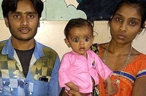 7 aylıq qızın qarnından əkiz bacısı çıxdı - Həkimlər ŞOKDA 