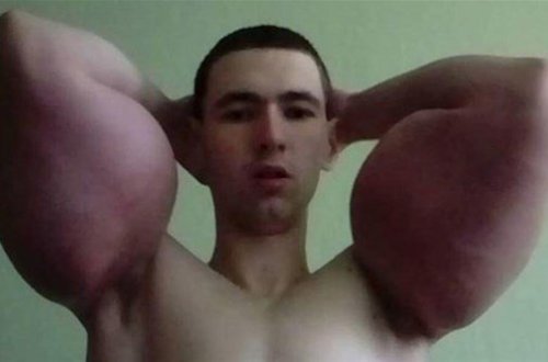 Bədəninə iynə vurdu, qorxunc hala düşdü - şok FOTOLAR