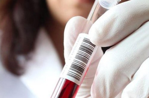 Nikaha girmək istəyən 280 nəfər həkimdən bəd xəbər aldı - AÇIQLAMA