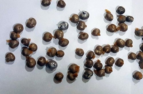 Bağırsağından 100 qram narkotika çıxdı