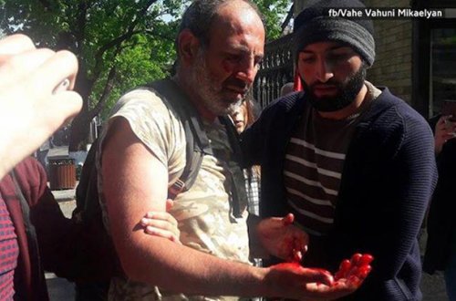 Ermənistanda aksiyaya qatılan deputat xəstəxanalıq oldu