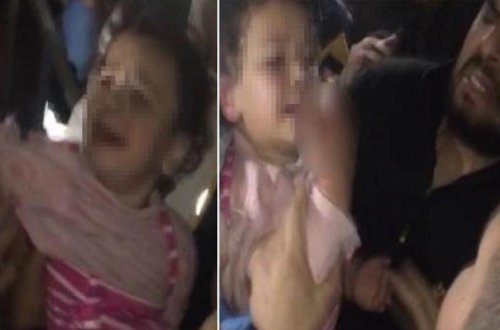 Liftdə qalan 4 yaşlı uşağın barmaqları qopdu - Foto