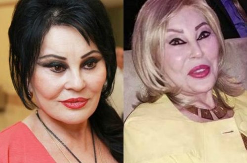 Amaliya Pənahova görüntüsü ilə təəccübləndirdi – FOTO