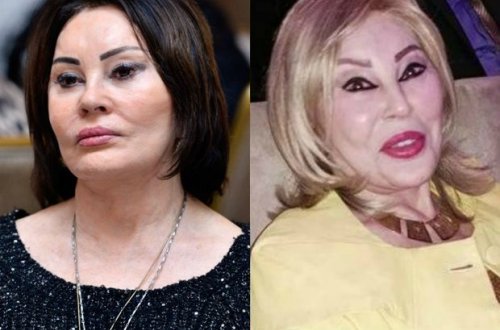 Amaliya Pənahova fotosu haqda: İşığı düz tutmayıblar – VİDEO