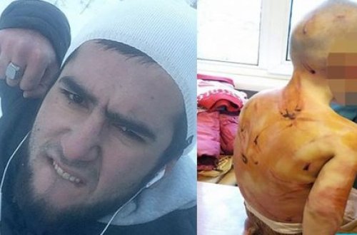 Azərbaycanlı ata 5-ə qədər saya bilmədiyi üçün 4 yaşlı qızına işgəncə verdi - FOTO