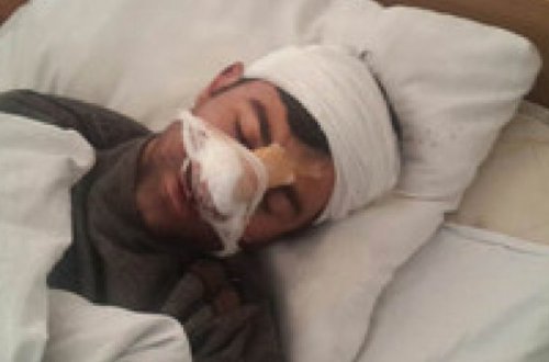 Yardımlı sakini ata və oğul tərəfindən baltalanıb - FOTO