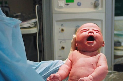 Cinsiyyət orqanında problemlər olan oğlan uşağı doğulub - AZƏRBAYCANDA