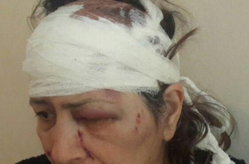 Sumqayıt sakini qayınanasını döydü - FOTO