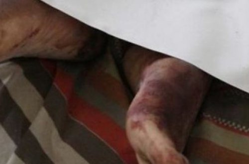 Ağır qəza törətdi, arvadı öldü - Bakıda