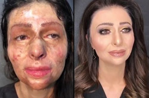 “Evə getdim, makiyajı sildim...” - Anarın dəyişdiyi Nərmin