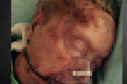 93 yaşlı qadını qocalar evində böcəklər yedi - DƏHŞƏTLİ ÖLÜM - FOTO