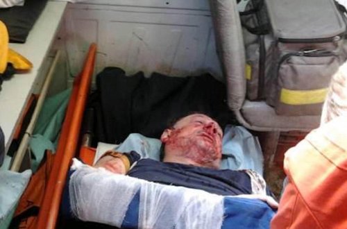 Eks-prezidentin tərəfdarı vəhşicəsinə döyüldü - Ukraynada