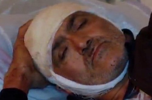 “Ötmək istəyirdim, maşınıma girdi” - 6 nəfərin yaralandığı dəhşətli qəzanın GÖRÜNTÜLƏRİ - VİDEO - FOTO