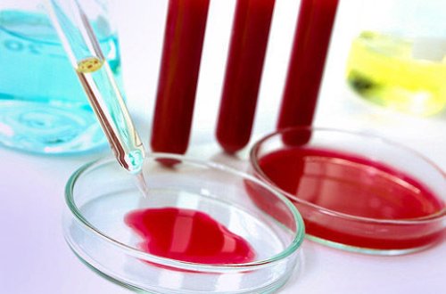 Ən təhlükəli qan qrupu müəyyən edilib