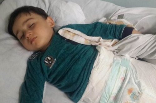 Azərbaycanda 3 yaşlı uşaq 2-ci mərtəbədən yıxılıb bu hala düşdü