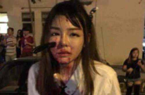 19 yaşlı qızın üzündə bıçaq qaldı - Şok kadrlar - VİDEO - FOTO