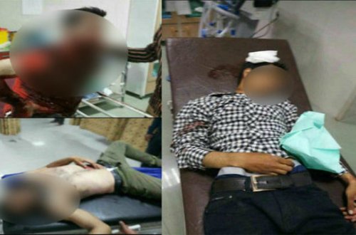 Reklam İranda vəziyyət gərginləşdi: xeyli sayda yaralı və ölü var