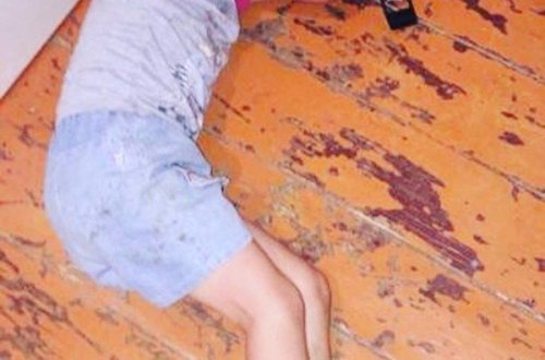 Azərbaycanda DƏHŞƏTLİ İŞGƏNCƏ: 5 yaşlı uşağa görün nələr etdilər - FOTO