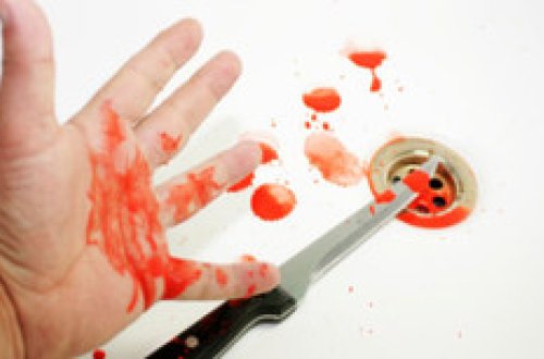 Mingəçevirdə qıza görə mübahisə edən şəxs damarlarını kəsib