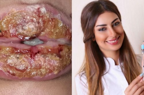 Kosmetoloqun qurbanı onun müstəntiqlə gizli ''sövdələşmə''sini etiraf etdi - TÜKÜRPƏDƏN GÖRÜNTÜLƏR