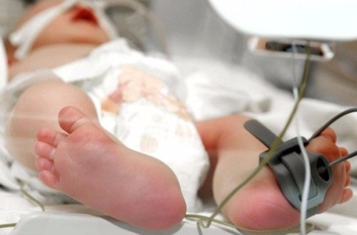 Azərbaycanda 1 yaşadək uşaqlar niyə ÖLÜRLƏR?