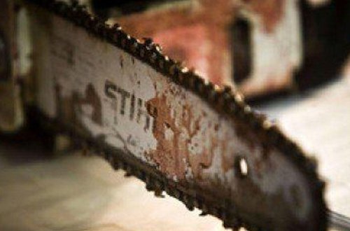 19 yaşlı gənc oğlan barmaqlarını kəsdi