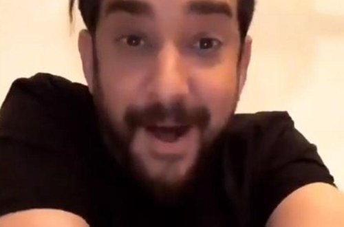 Məşhur aktyor çəkiliş zamanı yandı - FOTO