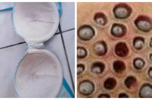 Bazardan aldığı büstqalter qadının sinəsini bu hala qoydu - FOTOLAR