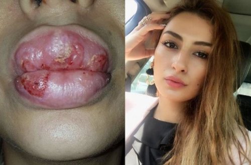 Elnarə Rzayeva daha bir xanımın dodaqlarını bu günə qoydu - Fotolar