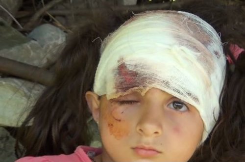 Şəkidə it uşağın başını qoparmaq istədi – VİDEO