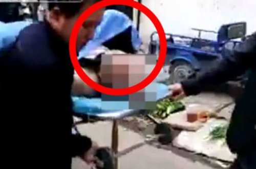 Cinsi əlaqə zamanı faciə: Xanım kişiyə yapışıb qaldı - Onları ayırmaq üçün həkimlər səfərbər oldu / VİDEO