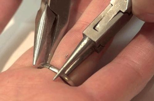 Bakı sakininin barmağında dəmir halqa qalıb