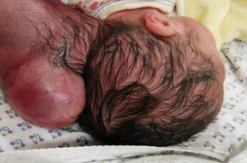 İki başlı uşaq dünyaya gəldi - FOTOLAR