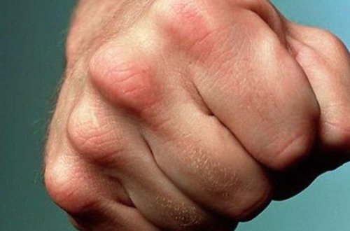 Bacısının döyülməsinə dözmədi - Yeznəsini xəstəxanalıq etdi