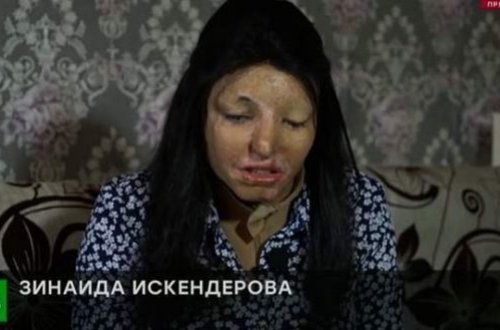 Rəfiqəsinin üzünə “kislota” tökdü və Azərbaycana qaçdı - VİDEO