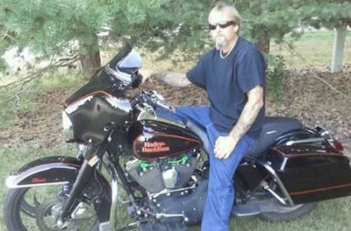 İt sahibini yaladı, kişinin bədəninə infeksiya düşdü, ayaqlarını kəsdilər - FOTO