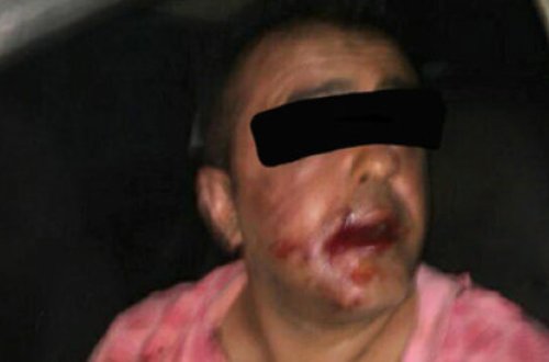 Gənc qıza zəng edib intim təkliflər edən şəxsin həyatını polis xilas etdi - FOTO