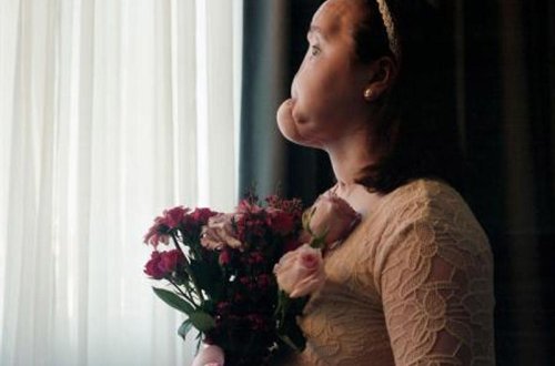 Dünyada ilk dəfə: üzünü məhv etmiş qızın siması bərpa olundu - VİDEO - FOTO