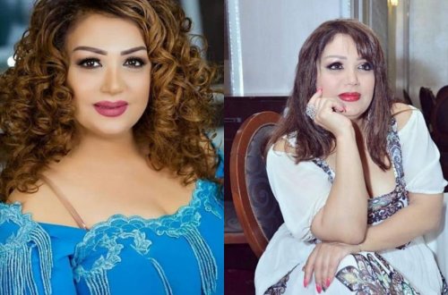 Mənzurə qaynaqlarını çıxardı, görünüşünü dəyişdi - Fotolar