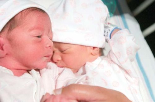 Əkizlərdən biri öldü, digərinin vəziyyəti ağırdır - Bakıda