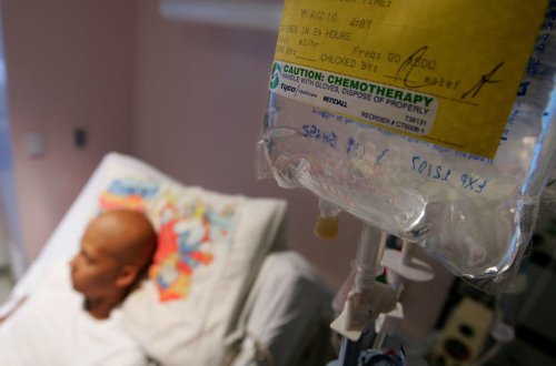 Süd vəzi xərçənginə qalib gəlmək üçün yeni üsul tapıldı