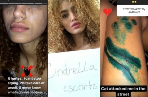 Bakirəliyini satışa çıxaran azərbaycanlı qız hücuma məruz qaldı - FOTOLAR