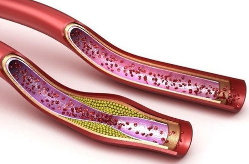 Damarları təmizləyən, ürəyi qoruyan yağlı məhsul - hər gün yeyin!