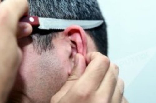 Azərbaycanda DƏHŞƏTLİ OLAY: 21 yaşlı oğlanın qulağını kəsdilər - TƏFƏRRÜAT - YENİLƏNDİ